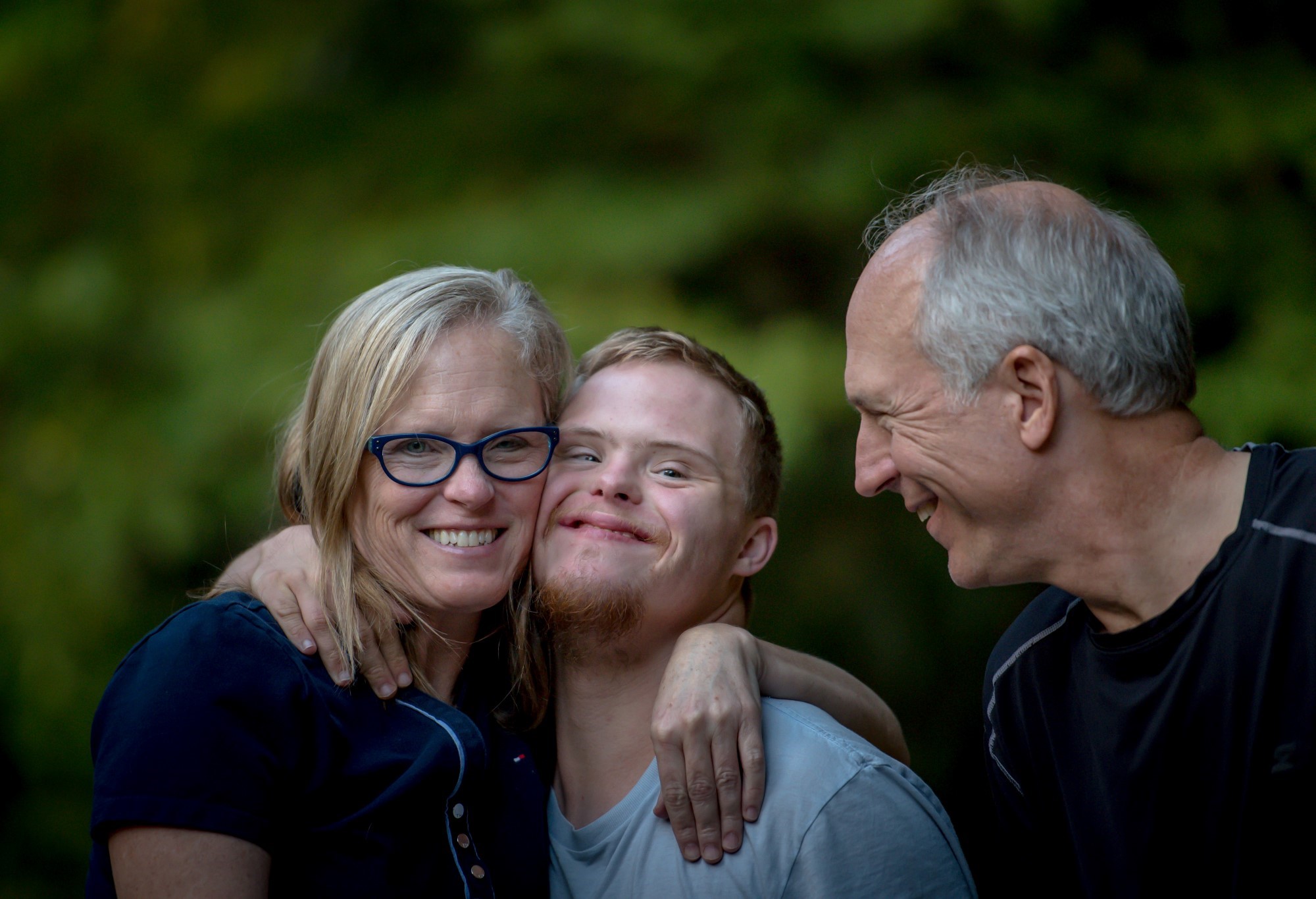 Downs Syndrom